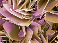 Stones, Heart Disease Linked