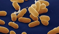 Managing Post-Transplant Infections