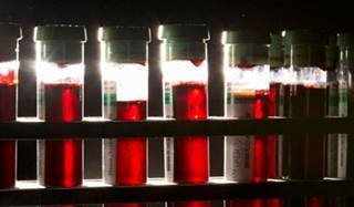 What is a normal GFR for a 75-year-old woman would be misdiagnosed as CKD under current guidelines. What is a normal GFR for a 75-year-old woman would be misdiagnosed as CKD under current guidelines.