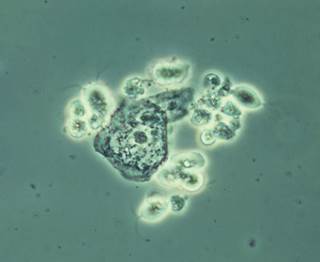Trichomonas vaginalis Trichomonas vaginalis