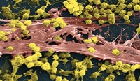Methicillin-resistant Staphylococcus aureus is causing an increasing number of infections.