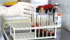 Better Tools Needed for NutritionRelated Screening