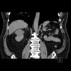 October 2011 Does Past Pathology Predict Future Results