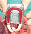 Nephrologists and Urologists Collaborate on Implantable Artificial Kidney