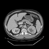 December 2011 Leave No Adrenal Behind  Still the Right Policy