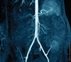 Deceased Donor Transplantation