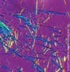 Clinical Challenges and Renal Considerations In Managing Gout