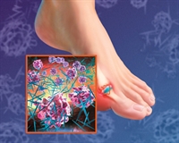 Part II: Clinical Challenges and Renal Considerations in Managing Gout