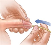 Part I: Assessment and Diagnostic Strategies for Neurogenic Bladder