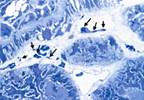 Fabry Disease: The Nephrologist's Role Fabry Disease: The Nephrologist's Role