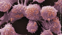 Current Controversies
Surrounding PSA Screening