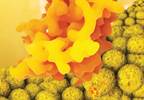 BMI is More Reliable than Leptin Levels in Dialysis Patients BMI is More Reliable than Leptin Levels in Dialysis Patients