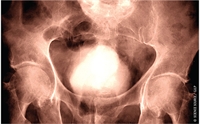 Medical and Surgical Management of Bladder Outlet Obstruction