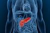 Vitamin D May Protect Against Bladder Cancer Vitamin D May Protect Against Bladder Cancer