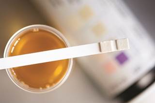 It is more sensitive than digital rectal examination and transrectal ultrasound. It is more sensitive than digital rectal examination and transrectal ultrasound.