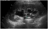A Case of Familial Polyuria A Case of Familial Polyuria