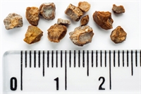 does tamsulosin prevent kidney stones