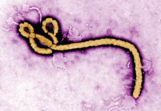 Physicians provided details of the first successful delivery of RRT to a patient with Ebola. Physicians provided details of the first successful delivery of RRT to a patient with Ebola.