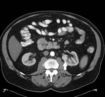 Renal & Urology News: World Review for Urologists Renal & Urology News: World Review for Urologists