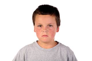 According to the CDC, 102 individuals from 14 states were reported to have measles in Jan 2015. According to the CDC, 102 individuals from 14 states were reported to have measles in Jan 2015.
