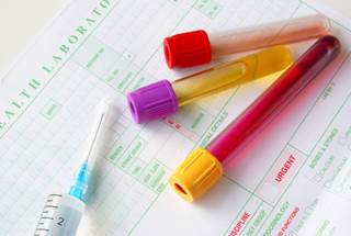 Phosphorus levels are higher when blood specimens are collected after weekends. Phosphorus levels are higher when blood specimens are collected after weekends.