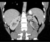 Cystic Enhancing Renal Mass in a Young Adult