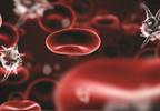 New Criteria Developed for Sepsis New Criteria Developed for Sepsis