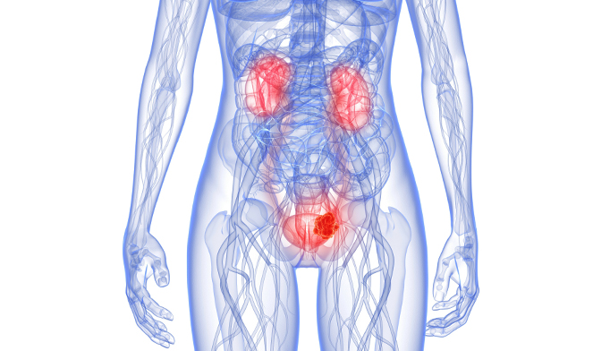 Bladder Cancer Urine Test Accurate Renal And Urology News