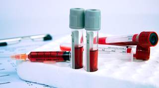 Researchers found that HbA1c was reduced by 1.2% at 6 months among study participants. Researchers found that HbA1c was reduced by 1.2% at 6 months among study participants.