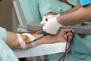 Higher Mortality Found After RFA In ESRD Dialysis Patients Renal And 