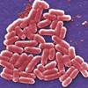 Infectious Disease-Related AKI Characterized Infectious Disease-Related AKI Characterized