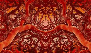 Shock waves may improve penile vasculature. Shock waves may improve penile vasculature.