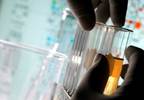Treating Albuminuria Reduces CV Events, Death in Type 2 Diabetes Treating Albuminuria Reduces CV Events, Death in Type 2 Diabetes