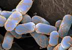 Multidrug-Resistant Bacteria Found in UTI Patient Multidrug-Resistant Bacteria Found in UTI Patient