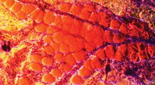 Study findings suggest adiposity may carry a risk for cancers. Study findings suggest adiposity may carry a risk for cancers.