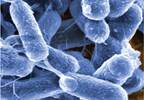 Bacteremia Worsens Kidney Transplant Outcomes Bacteremia Worsens Kidney Transplant Outcomes