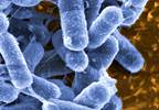 Antibiotic Combo Found to Reduce Post-Transplant UTI Rate Antibiotic Combo Found to Reduce Post-Transplant UTI Rate