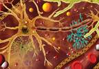 Hyponatremia: An Update on the Management of SIADH Hyponatremia: An Update on the Management of SIADH