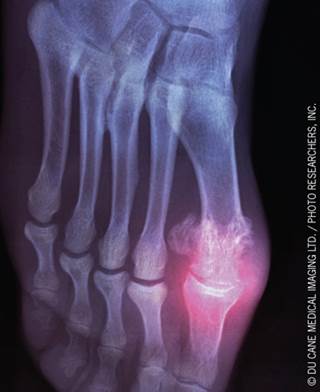 Clinicians should be aware of these uncommon radiograph findings. Clinicians should be aware of these uncommon radiograph findings.