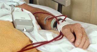 AF occurred more often on a dialysis day and especially during dialysis. AF occurred more often on a dialysis day and especially during dialysis.