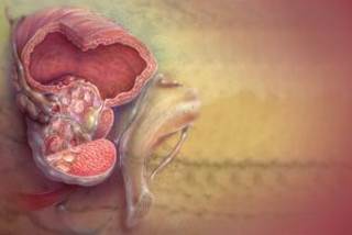 The treatment is associated with a decreased risk of all-cause mortality in men at high risk. The treatment is associated with a decreased risk of all-cause mortality in men at high risk.