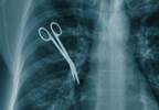 Surgical 'Never Events' Occur At Least 4,000 Times Annually Surgical 'Never Events' Occur At Least 4,000 Times Annually