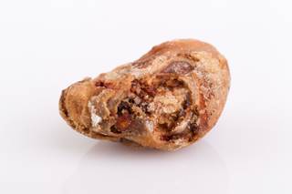 Only 1% of patients develop kidney stones after kidney transplantation. Only 1% of patients develop kidney stones after kidney transplantation.