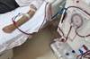 Poor Dental Health Boosts Mortality Risk in ESRD Poor Dental Health Boosts Mortality Risk in ESRD