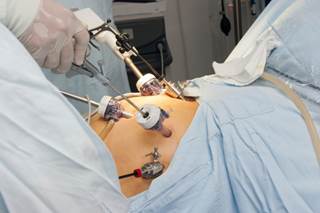 Research suggests greater success in weight loss and remission compared to lifestyle changes. Research suggests greater success in weight loss and remission compared to lifestyle changes.