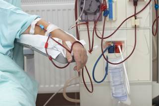 59% of men with ESRD were on hemodialysis versus 41% of women. 59% of men with ESRD were on hemodialysis versus 41% of women.