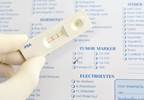 Low-PSA, High-Grade Prostate Cancer Especially Lethal Low-PSA, High-Grade Prostate Cancer Especially Lethal