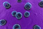 Premature Ejaculation Linked to Chlamydia in Prostatitis Patients Premature Ejaculation Linked to Chlamydia in Prostatitis Patients