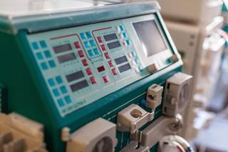 IV iron in anemia hemodialysis patients hospitalized for infections found not to worsen outcomes. IV iron in anemia hemodialysis patients hospitalized for infections found not to worsen outcomes.