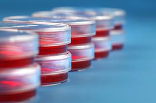 Highest vs. lowest quintile of hemoglobin associated with 6-fold increased odds of complete or partial recovery. Highest vs. lowest quintile of hemoglobin associated with 6-fold increased odds of complete or partial recovery.